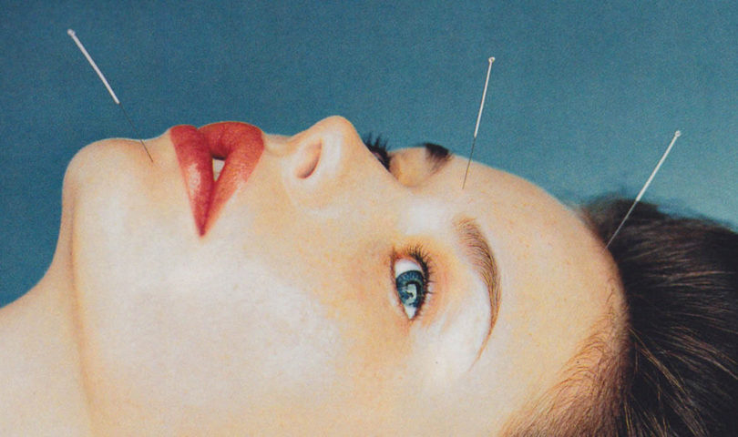 Better than Botox? I tried cosmetic acupuncture for the first time, and this is what happened