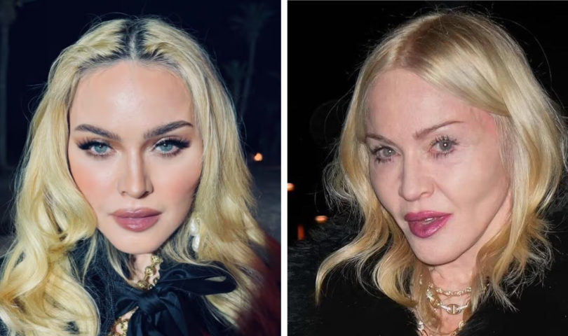 A leading Auckland cosmetic doctor explains filtered perfection vs real results